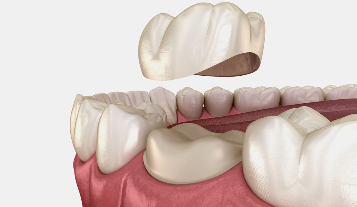 treatment inner thumb