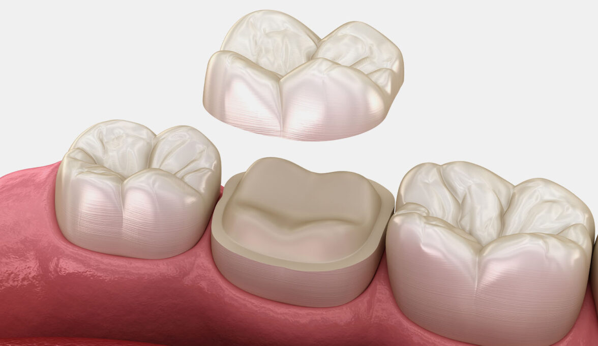 treatment inner thumb